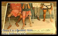 Photo de mutilés